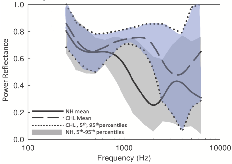 Fig 3 from Prieve showing 5-95% percentiles for normal and CHL ears.