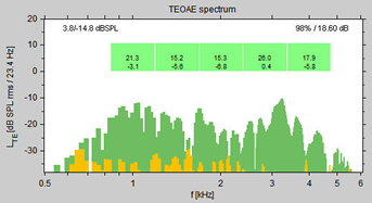 TEOAE test showing a Pass result in 5 bands.