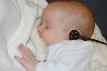 A baby receives a MEPA test as part of an infant hearing screening program