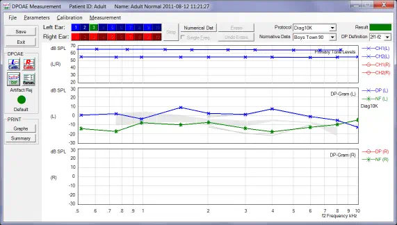 Screenshot of a DPOAE test using HearID